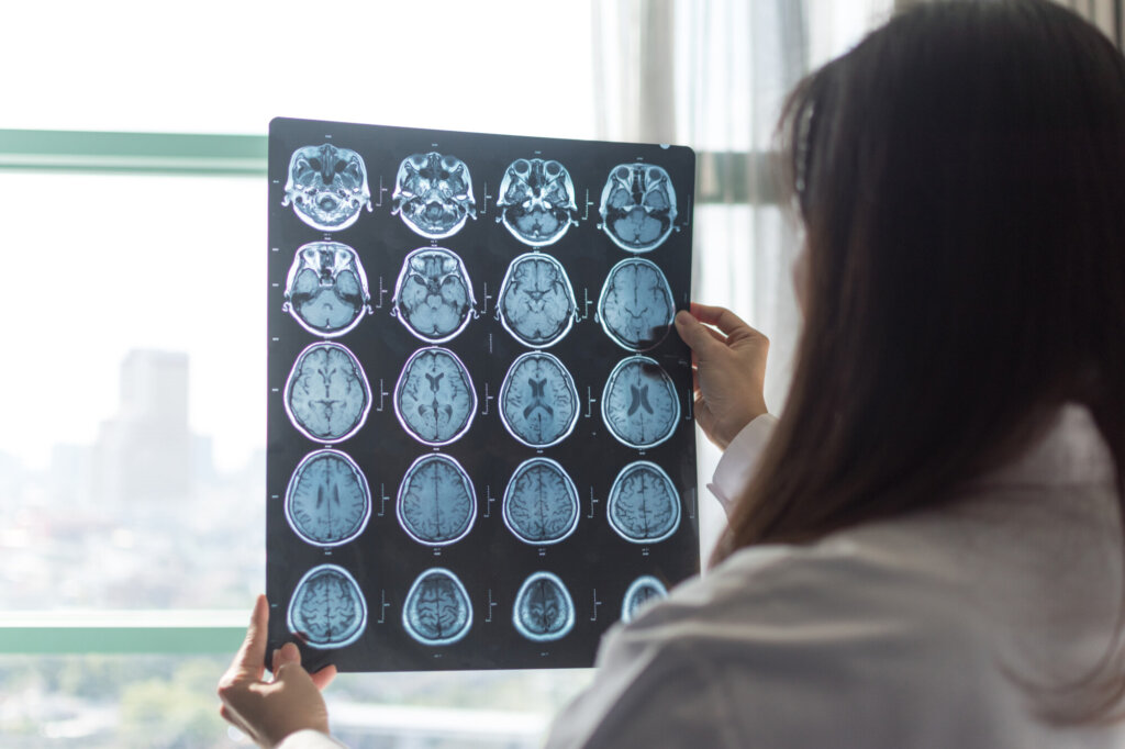 Alzheimer Society Research Program Award: digital x-ray of brain